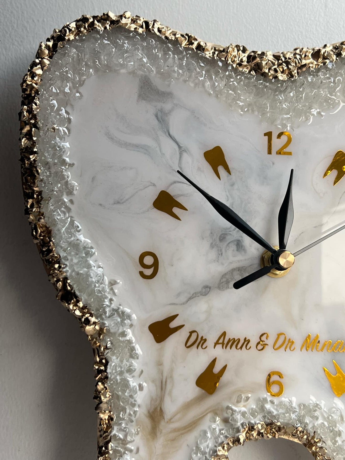 Custom Resin Tooth Clock, Dental Office Decor, Epoxy Wall Clock, Personalized Tooth Gift